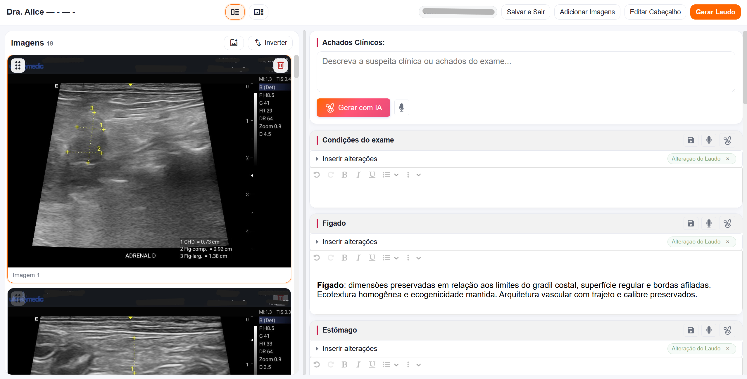 LaudoFacil Interface